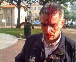 Le commissaire de police de Draguignan Philippe Granata blessé lors d'affrontements avec des Kurdes le 16 XII 2015 (DR)